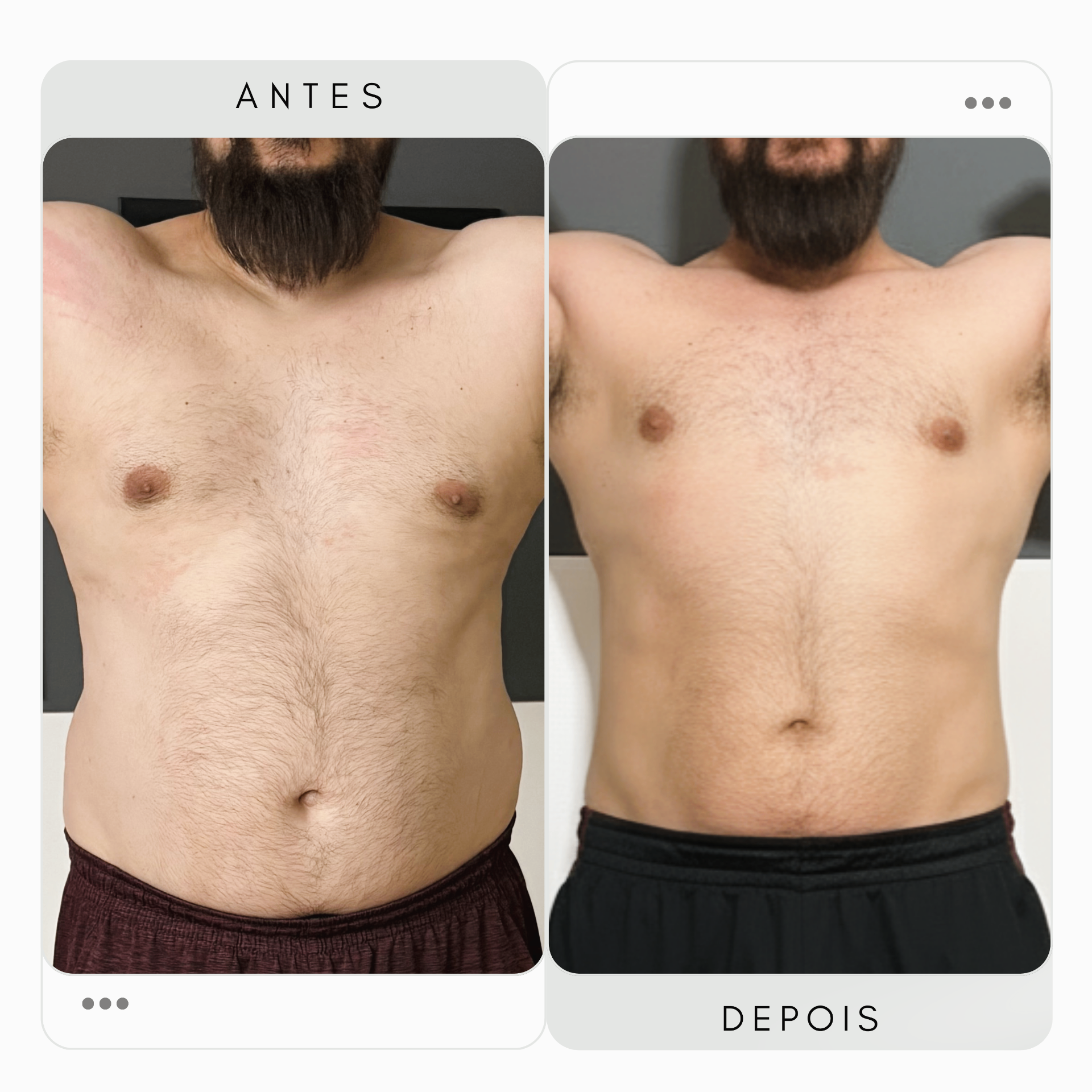 Redução de Gordura